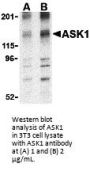 ASK1 Antibody