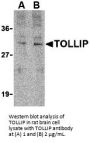 TOLLIP Antibody