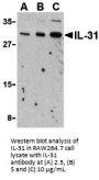 IL-31 Antibody