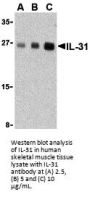 IL-31 Antibody