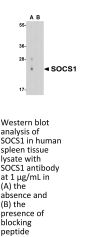 SOCS1 Antibody