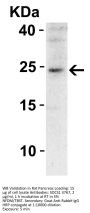 SOCS1 Antibody