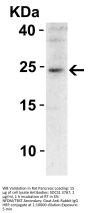 SOCS1 Antibody