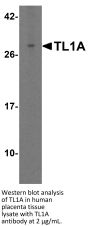 TL1A Antibody