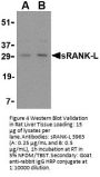 sRANK Ligand Antibody