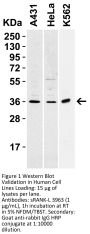 sRANK Ligand Antibody