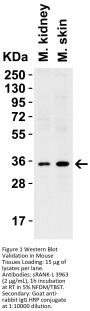 sRANK Ligand Antibody