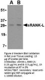 sRANK Ligand Antibody