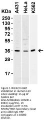 sRANK Ligand Antibody
