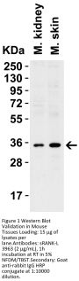 sRANK Ligand Antibody