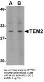 TEM2 Antibody