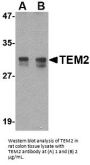 TEM2 Antibody