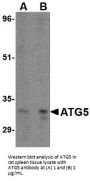 ATG5 Antibody