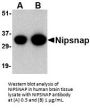 NIPSNAP Antibody