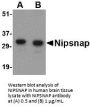 NIPSNAP Antibody