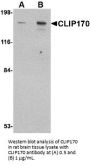 CLIP170 Antibody