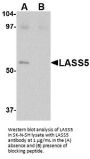 LASS5 Antibody