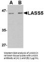 LASS5 Antibody