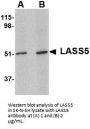 LASS5 Antibody