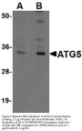 ATG5 Antibody