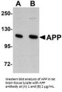 APP Antibody
