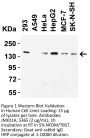 JMJD1A Antibody