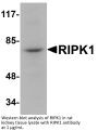 RIPK1 Antibody