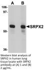 SRPX2 Antibody