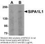SIPA1L1 Antibody