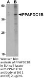 PPAPDC1B Antibody