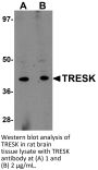 TRESK Antibody