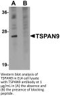 TSPAN9 Antibody