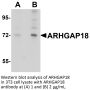 ARHGAP18 Antibody