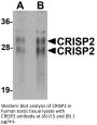 CRISP2 Antibody