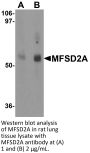 MFSD2A Antibody