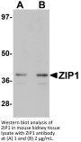 ZIP1 Antibody