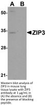 ZIP3 Antibody