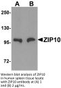 ZIP10 Antibody