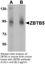 ZBTB5 Antibody
