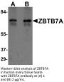 ZBTB7A Antibody