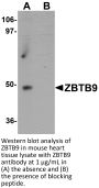 ZBTB9 Antibody