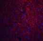 PION Antibody