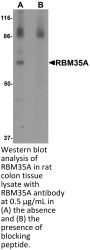 RBM35A Antibody