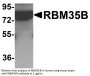 RBM35B Antibody
