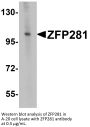 ZFP281 Antibody