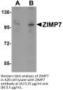 ZIMP7 Antibody
