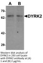 DYRK2 Antibody