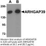 ARHGAP39 Antibody