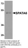SPATA6 Antibody