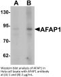 AFAP1 Antibody